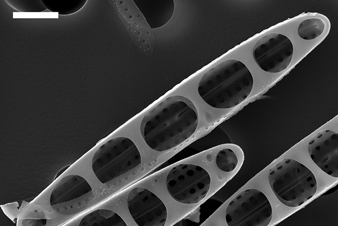 Geskandeerde elektronmikroskopiebeeld van die diatoom Nagumoea hydrophicola (interne beeld). Skaalbalk = 1 µm (mikrometer)